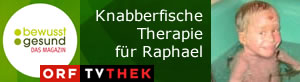 Knabberfische Therapie fuer Raphael